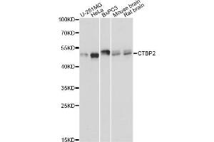 Western blot analysis of extracts of various cell lines, using CTBP2 Antibody (ABIN5971262) at 1:3000 dilution. (CTBP2 抗体)