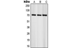 Western blot analysis of S6K1 (pS418) expression in NIH3T3 (A), HeLa (B), KNRK (C) whole cell lysates. (RPS6KB1 抗体  (C-Term, pSer418))
