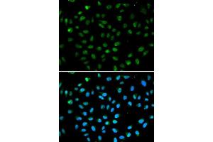 Immunofluorescence analysis of A549 cell using ATF6 antibody. (ATF6 抗体  (AA 1-190))