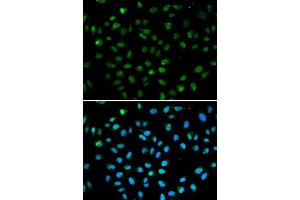 Immunofluorescence analysis of A549 cell using ATF6 antibody. (ATF6 抗体  (AA 1-190))