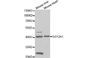 Western Blotting (WB) image for anti-General Transcription Factor IIA, 1, 19/37kDa (GTF2A1) antibody (ABIN1876533) (GTF2A1 抗体)