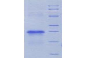 SDS-PAGE analysis of Rat uPAR Protein. (PLAUR 蛋白)