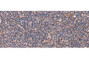 Immunohistochemistry of paraffin-embedded Human tonsil tissue using JAM3 Polyclonal Antibody at dilution of 1:45(x200) (JAM3 抗体)