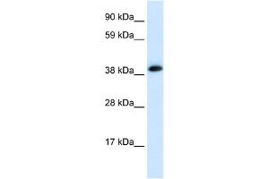 WB Suggested Anti-CHRNA1 Antibody Titration:  0. (CHRNA1 抗体  (C-Term))