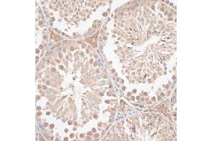 Immunohistochemistry of paraffin-embedded mouse testis using VEGF Receptor 2 antibody (ABIN6132247, ABIN6142816, ABIN6142819 and ABIN6215074) at dilution of 1:100 (40x lens). (VEGFR2/CD309 抗体  (AA 20-200))