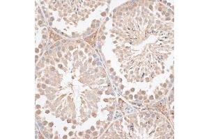 Immunohistochemistry of paraffin-embedded mouse testis using VEGF Receptor 2 antibody (ABIN6132247, ABIN6142816, ABIN6142819 and ABIN6215074) at dilution of 1:100 (40x lens). (VEGFR2/CD309 抗体  (AA 20-200))