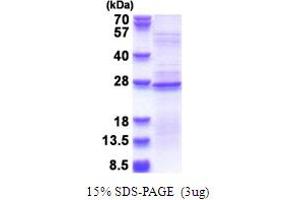 SDS-PAGE (SDS) image for Ribosomal Protein L18a (RPL18A) (AA 1-176) protein (His tag) (ABIN5853691) (RPL18A Protein (AA 1-176) (His tag))