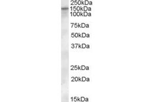 Western Blotting (WB) image for anti-Solute Carrier Family 12 (Potassium-Chloride Transporter) Member 4 (SLC12A4) (Internal Region) antibody (ABIN2465865) (SLC12A4 抗体  (Internal Region))