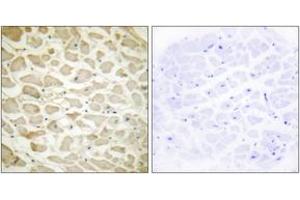 Immunohistochemistry analysis of paraffin-embedded human heart tissue, using Collagen XIV alpha1 Antibody. (COL14A1 抗体  (AA 71-120))