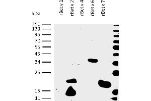 Presence of sIgE antibodies specific to recombinant allergens Bet v 1, Bet v 2, Bet v 4, Bet v 6, and Bet v 7 was analysed in plasma of a patient with confirmed presence (routine clinical test) of specific IgE antibodies to birch pollen allergen extract.