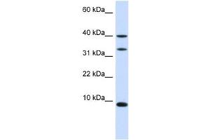 DBI antibody used at 1 ug/ml to detect target protein. (Diazepam Binding Inhibitor 抗体)