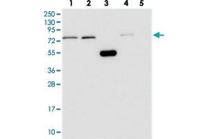 Western blot analysis of Lane 1: RT-4, Lane 2: U-251 MG, Lane 3: Human Plasma, Lane 4: Liver, Lane 5: Tonsil with WDR35 polyclonal antibody . (WDR35 抗体)