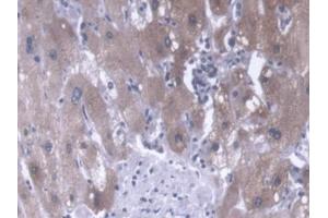 DAB staining on IHC-P; Samples: Human Liver Tissue (CANT1 抗体  (AA 107-400))