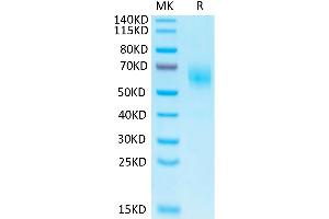 Biotinylated Human IL-1 Rrp2 on Tris-Bis PAGE under reduced condition. (IL1RL2 Protein (AA 20-335) (His-Avi Tag,Biotin))
