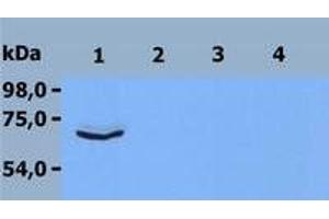 Western Blotting (WB) image for anti-zeta-Chain (TCR) Associated Protein Kinase 70kDa (ZAP70) (C-Term) antibody (ABIN238530) (ZAP70 抗体  (C-Term))