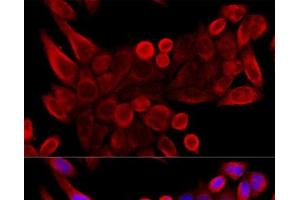 Immunofluorescence analysis of HeLa cells using VDAC3 Polyclonal Antibody at dilution of 1:100 (40x lens). (VDAC3 抗体)