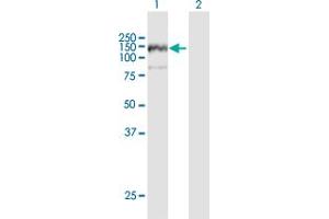 Western Blot analysis of ANKFY1 expression in transfected 293T cell line by ANKFY1 MaxPab polyclonal antibody. (ANKFY1 抗体  (AA 1-1170))