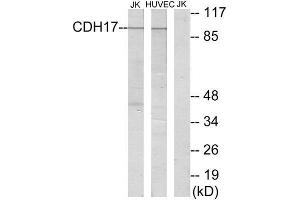 Western Blotting (WB) image for anti-LI Cadherin (Internal Region) antibody (ABIN1850218) (LI Cadherin 抗体  (Internal Region))