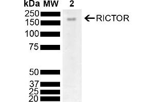 Western blot analysis of Mouse Brain showing detection of 192 kDa RICTOR protein using Rabbit Anti-RICTOR Polyclonal Antibody (ABIN5696206). (RICTOR 抗体  (AA 1060-1160) (PerCP))