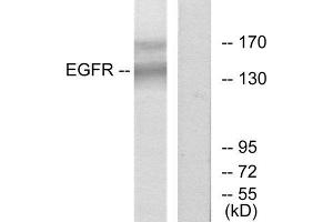 Western Blotting (WB) image for anti-Epidermal Growth Factor Receptor (EGFR) (Tyr1172) antibody (ABIN1848098) (EGFR 抗体  (Tyr1172))