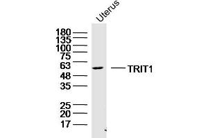 Mouse uterus lysates probed with TRIT1 Polyclonal Antibody, Unconjugated  at 1:300 dilution and 4˚C overnight incubation. (TRIT1 抗体  (AA 121-220))