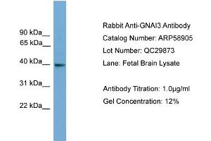 WB Suggested Anti-GNAI3  Antibody Titration: 0. (GNAI3 抗体  (N-Term))