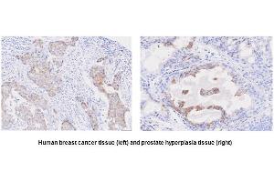 Immunohistochemistry (IHC) image for anti-Six Transmembrane Epithelial Antigen of The Prostate 1 (STEAP1) (AA 1-70), (N-Term) antibody (ABIN317568) (STEAP1 抗体  (N-Term))