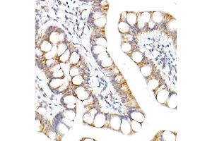 Immunohistochemistry of paraffin-embedded human small intestine using NDUF Rabbit mAb (ABIN7268797) at dilution of 1:50 (40x lens). (NDUFA1 抗体)