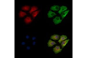 ABIN6256691 and ABIN6267080 staining Hela cells(heat shock treatment) by IF/ICC. (Connexin 43/GJA1 抗体  (pTyr265))