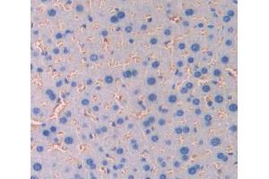 Used in DAB staining on fromalin fixed paraffin- embedded Kidney tissue (CD236/GYPC 抗体  (AA 1-95))