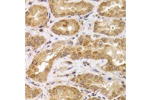 Immunohistochemistry of paraffin-embedded human kidney using  antibody (ABIN6127359, ABIN6136867, ABIN6136868 and ABIN6222919) at dilution of 1:100 (40x lens). (ANAPC5 抗体  (AA 1-250))