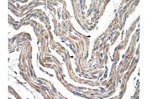 PDK4 antibody was used for immunohistochemistry at a concentration of 4-8 ug/ml to stain Skeletal muscle cells (arrows) in Human Muscle. (PDK4 抗体  (N-Term))