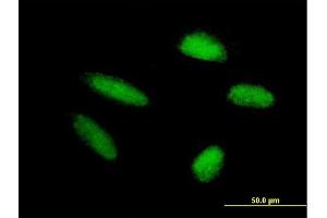 Immunofluorescence of purified MaxPab antibody to TRIM46 on HepG2 cell. (TRIM46 抗体  (AA 1-498))