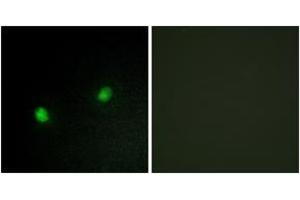 Immunofluorescence analysis of HeLa cells, using ZNF7 Antibody. (ZNF7 抗体  (AA 41-90))