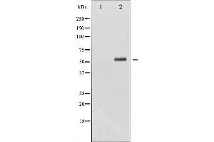 Western blot analysis of Chk2 phosphorylation expression in UV treated HeLa whole cell lysates,The lane on the left is treated with the antigen-specific peptide. (CHEK2 抗体  (pSer516))