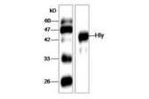 Image no. 1 for anti-Listeria Monocytogenes Hly (AA 20-119) antibody (ABIN791324) (Listeria Monocytogenes Hly (AA 20-119) 抗体)