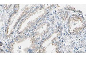 ABIN6276592 at 1/100 staining Human prostate tissue by IHC-P. (K-RAS 抗体  (C-Term))