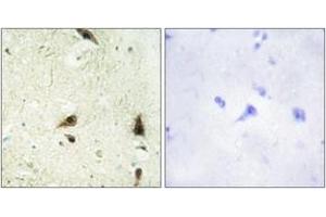 Immunohistochemistry analysis of paraffin-embedded human brain tissue, using CHRC1 Antibody. (CHRAC1 抗体  (AA 81-130))