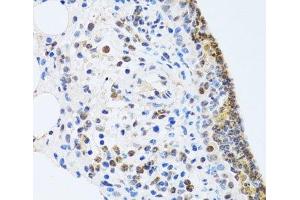 Immunohistochemistry of paraffin-embedded Rat lung using MTA3 Polyclonal Antibody at dilution of 1:100 (40x lens). (MTA3 抗体)