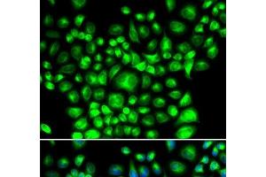 Immunofluorescence analysis of U2OS cells using BCAP31 Polyclonal Antibody (BCAP31 抗体)