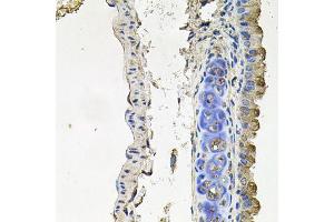 Immunohistochemistry of paraffin-embedded mouse lung using NDUFA6 antibody (ABIN6003563) at dilution of 1/100 (40x lens). (NDUFA6 抗体)