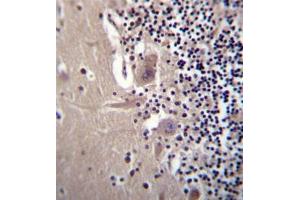 Formalin fixed, paraffin embedded human cerebellum tissue stained with Beta-crystallin A3 Antibody  followed by peroxidase conjugation of the secondary antibody and DAB staining. (CRYBA1 抗体  (Middle Region))
