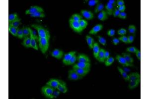 Immunofluorescence staining of HepG2 cells with ABIN7158901 at 1:200, counter-stained with DAPI.