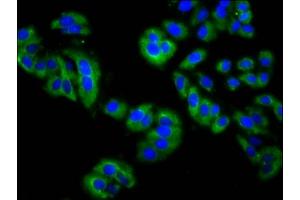 Immunofluorescence staining of HepG2 cells with ABIN7158901 at 1:200, counter-stained with DAPI. (MPP3 抗体  (AA 301-432))