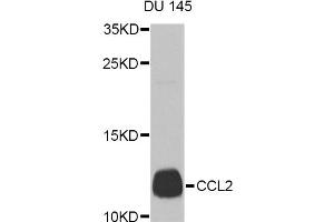 Western blot analysis of extracts of DU 145 cells, using CCL2 Antibody (ABIN5974379) at 1/1000 dilution. (CCL2 抗体)