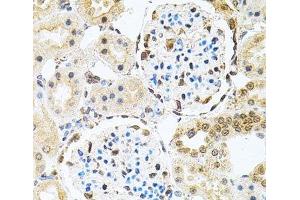 Immunohistochemistry of paraffin-embedded Rat kidney using PNKP Polyclonal Antibody at dilution of 1:100 (40x lens).