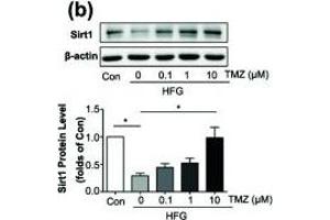 Trimetazidine (TMZ) reduced HFG-induced ROS generation and EMT depending on upregulation of Sirt1. (SIRT1 抗体  (AA 448-747))