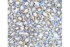Immunohistochemistry of paraffin-embedded Rat kidney using CTNNA1 Polyclonal Antibody at dilution of 1:100 (40x lens). (CTNNA1 抗体)