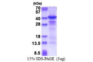 SDS-PAGE (SDS) image for Casein Kinase 1, alpha 1 (CSNK1A1) (AA 1-337) protein (His tag) (ABIN5853612) (CSNK1A1 Protein (AA 1-337) (His tag))
