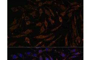 Immunofluorescence analysis of L929 cells using P90RSK Polyclonal Antibody at dilution of 1:100. (RPS6KA3 抗体)